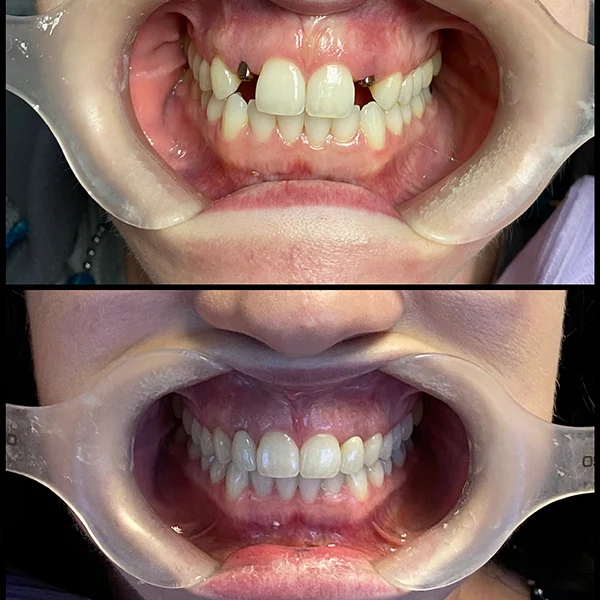 Cosmetic dentistry image from Dr. Jack Ohanesian DDS