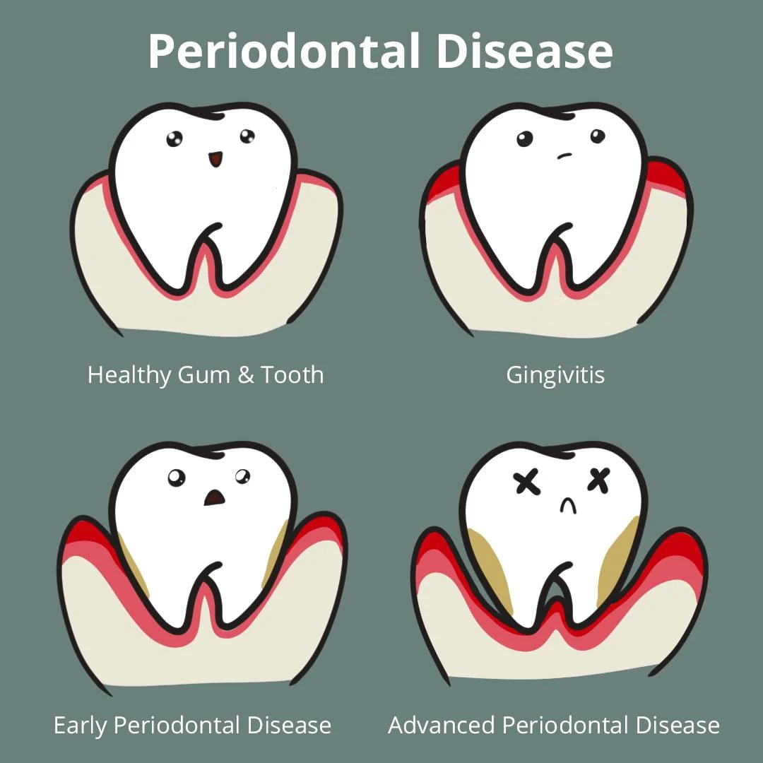 Periodontal care image
